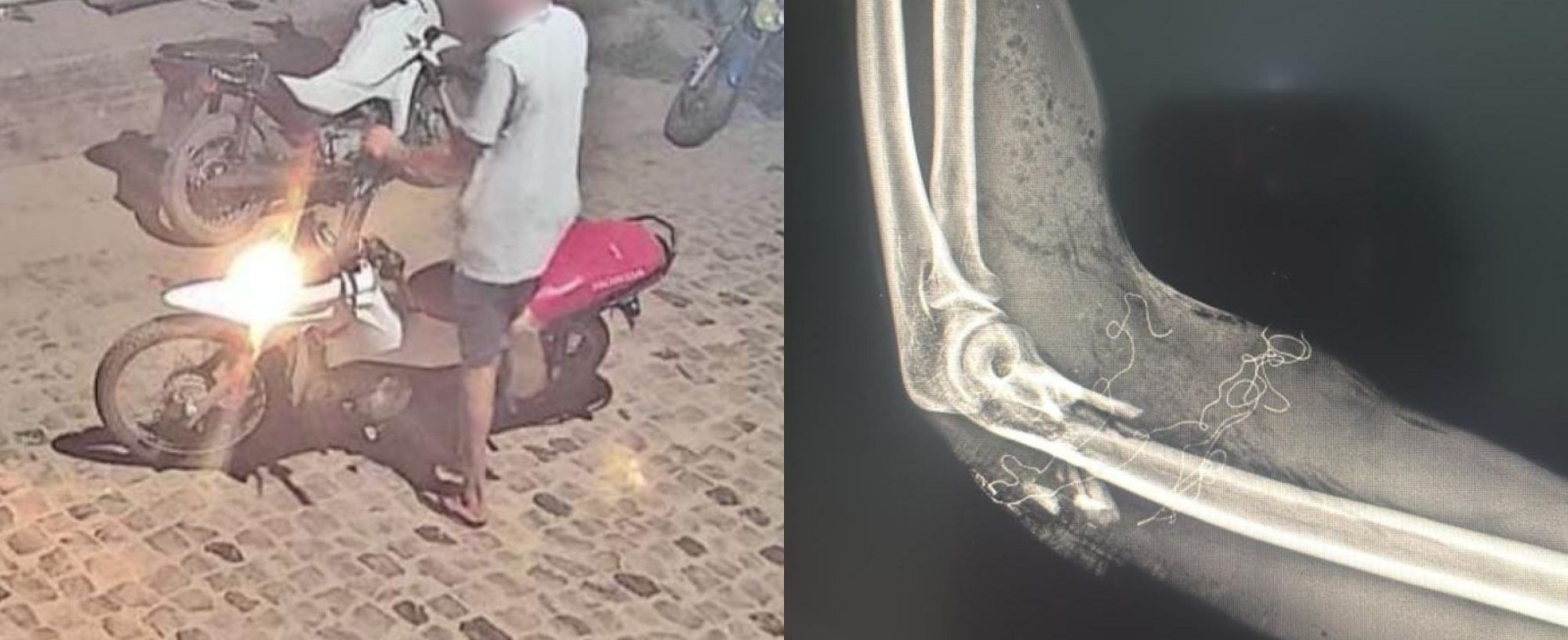 Jovem de 18 anos é baleado no braço enquanto entregava pizzas no PI