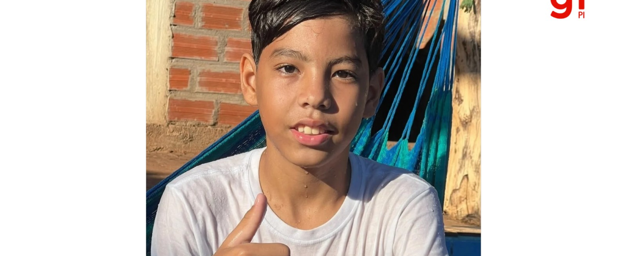 Campanha arrecada mais de 180 bolsas de sangue para adolescente internado após queda de bicicleta no PI